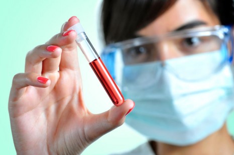 blood-sample