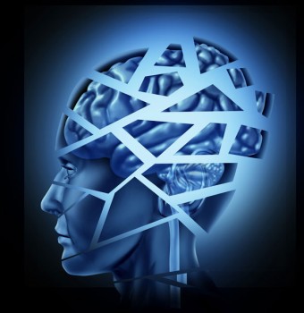 brain-injury-2