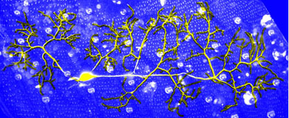 dendri