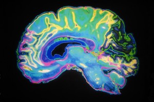 http://www.dreamstime.com/royalty-free-stock-photos-coloured-mri-scan-human-brain-image8398188